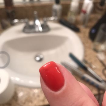 Chic Nails - Peeled and bubbled index finger - Nail Salons Near Me - Phoenix, Arizona