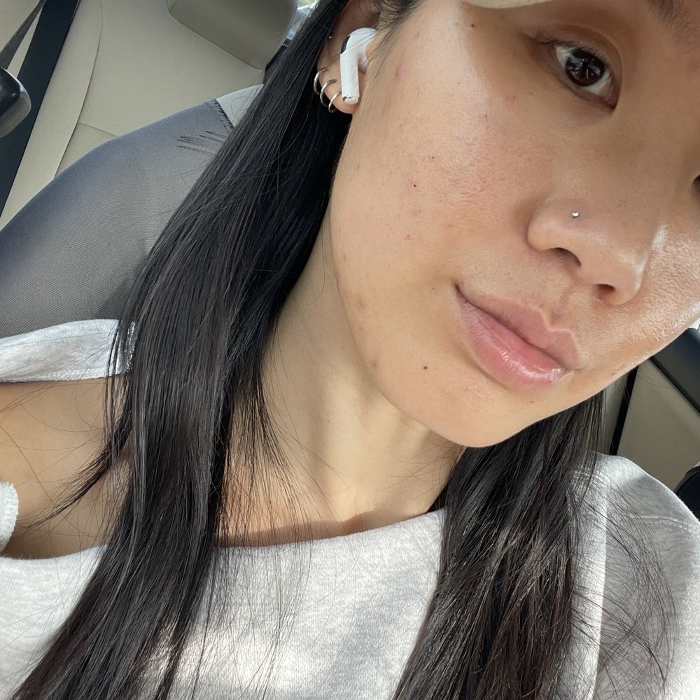 Tiara Aesthetics - Before any secret radio frequency and microneedling sessions - Medical Spas Near Me - Los Angeles, California Tiara Aesthetics - Before any secret radio frequency and microneedling sessions - Medical Spas Near Me - Los Angeles, California