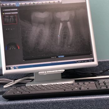 Beaches Endodontics - My first root canal - Endodontists Near Me - Jacksonville Beach, Florida Beaches Endodontics - My first root canal - Endodontists Near Me - Jacksonville Beach, Florida