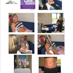 LV Plastic Surgery - Brian J. Parker M.D - Before & After Pictures
http://lvplasticsurgery.com/