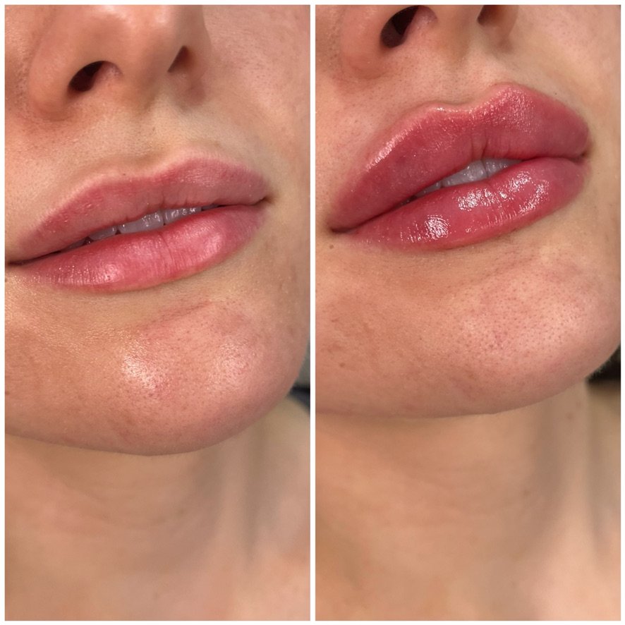 Morph Aesthetics Logo