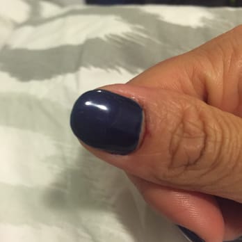 Myano Nails & Spa - Bloody cuticles - Skin Care Near Me - Seattle, Washington Myano Nails & Spa - Bloody cuticles - Skin Care Near Me - Seattle, Washington