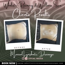 Wholistic Recovery & Wellness Spa