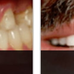 Elite Dental Group - Orthodontics Miami, FL