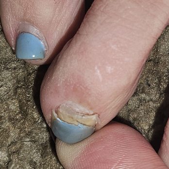 Mega Nail Bar - It got worse... I lost a whole nail... - Nail Salons Near Me - Santa Clara, California