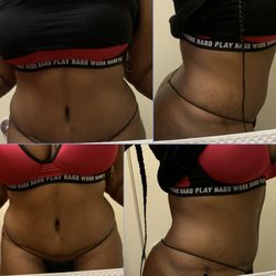 Dream Body Contouring