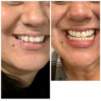 W Dentistry: Dr. Brad A Walker, DDS - Best investment ever! - General Dentistry Near Me - San Jose, California W Dentistry: Dr. Brad A Walker, DDS - Best investment ever! - General Dentistry Near Me - San Jose, California