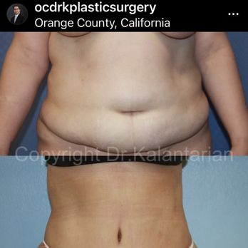 Dr K Plastic Surgery Orange County - Cosmetic Surgeons Near Me - Irvine, California Dr K Plastic Surgery Orange County - Cosmetic Surgeons Near Me - Irvine, California