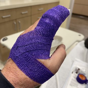 VanCraft - Hurt my finger trying to fix water house under sink . It was broken when they dropped van off. - RV Rental Near Me - Oceanside, California VanCraft - Hurt my finger trying to fix water house under sink . It was broken when they dropped van off. - RV Rental Near Me - Oceanside, California