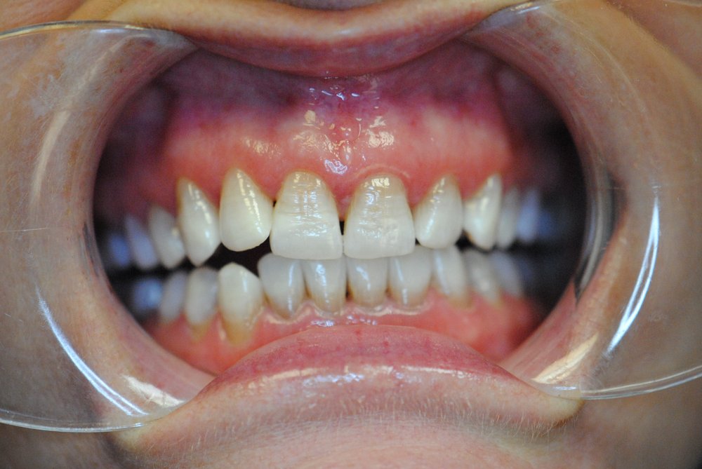 Davis Dental Center 19 Photos & 12 Reviews General Dentistry 902