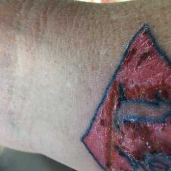 Mutiny Tattoo & Piercing - This is garbage got a huge cut from the artists can't oil for the infection a law suit will be coming - Piercing Near Me - Minneapolis, Minnesota