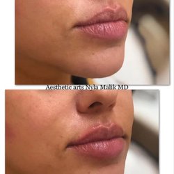Aesthetic Arts Medical Spa
