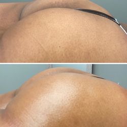 The Booty Bar