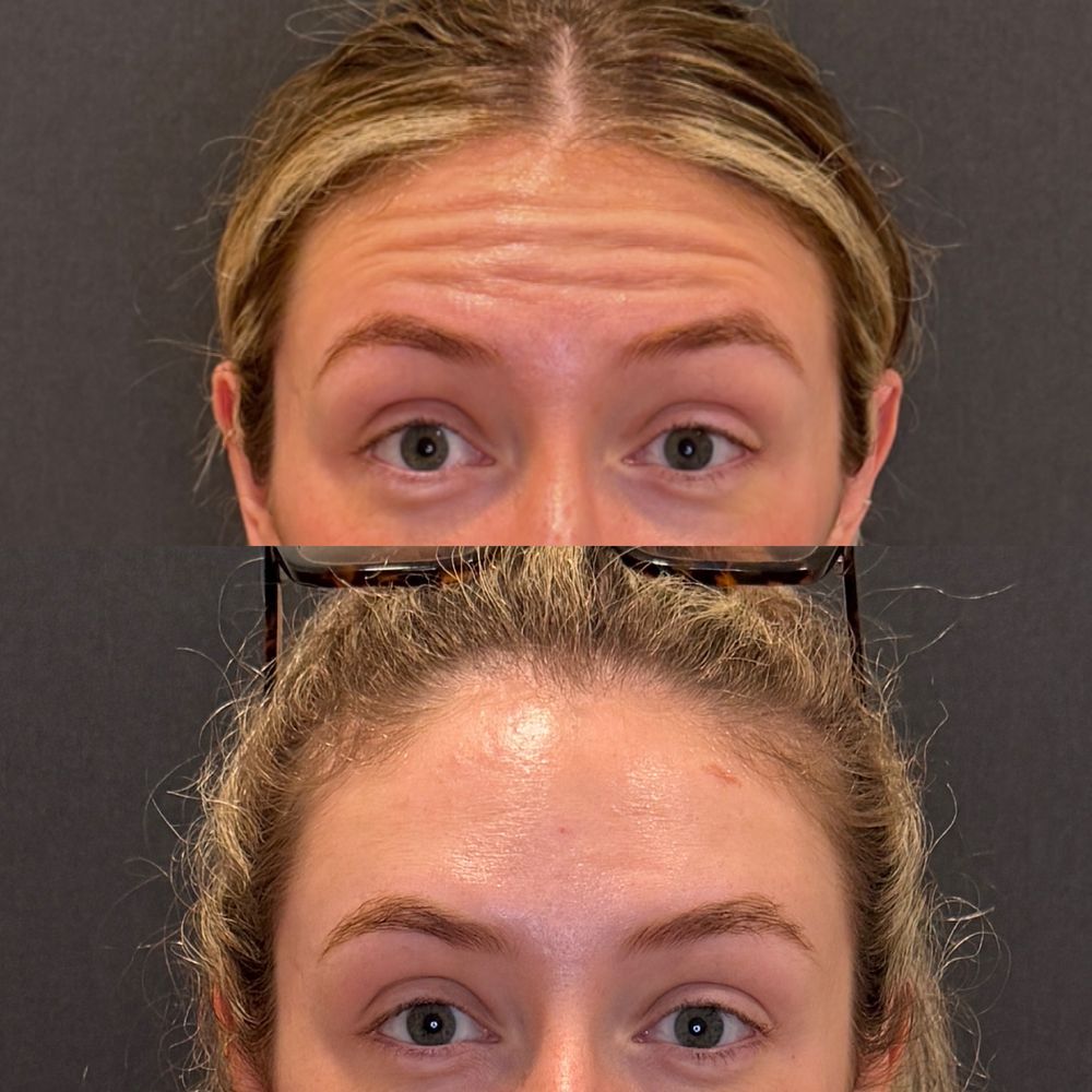 Renew Laser and Aesthetic Medicine Logo