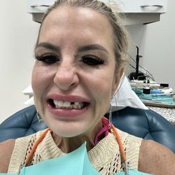 Bliss Dentistry - My tooth completely missing!!