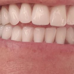Miller Dental Arts - I got exactly what I wanted. Im very happy!