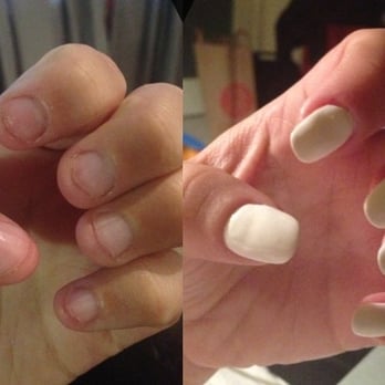 Bae Nail - Before and after Hellen did silk nails and transformed my gross bitten nails into long pretty nails :) - Nail Salons Near Me - Santa Monica, California