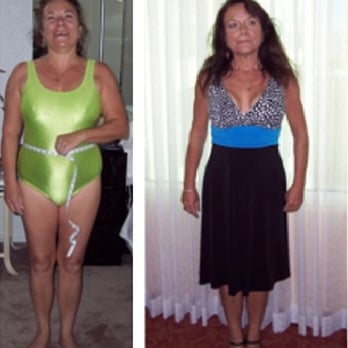 Accu-Weight Loss System - Lost 39 lbs! Results ARE typical. - Weight Loss Centers Near Me - West Orange, New Jersey Accu-Weight Loss System - Lost 39 lbs! Results ARE typical. - Weight Loss Centers Near Me - West Orange, New Jersey