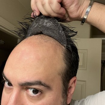 HAIRCLUB - Cosmetic Surgeons Near Me - Phoenix, Arizona HAIRCLUB - Cosmetic Surgeons Near Me - Phoenix, Arizona