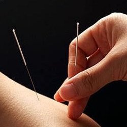 Green Touch Acupuncture