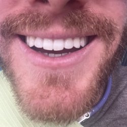 Enclave Dental - After