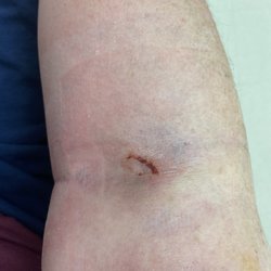 BioLife Plasma Services