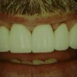 Helen S Kirscher, DDS