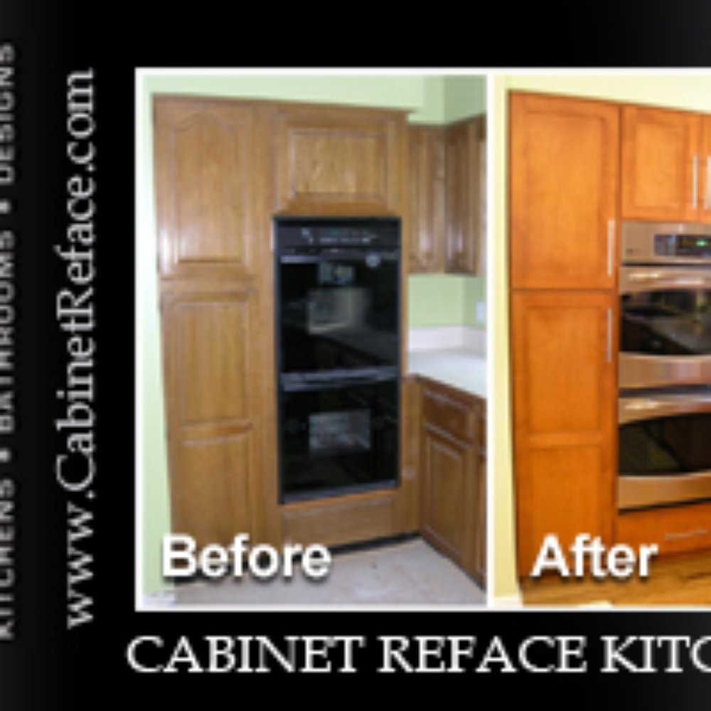 Refacing Kansas City Matttroy