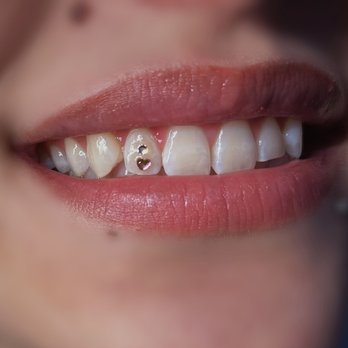 Kawaii Tooth Gems - Jewelry Near Me Kawaii Tooth Gems - Jewelry Near Me