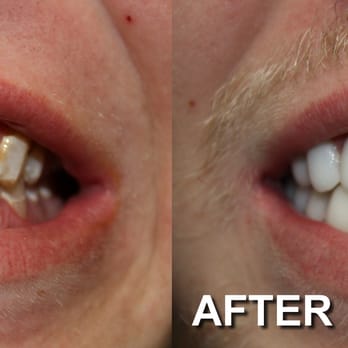 Jerrold Goldsmith, DDS FAGD - Cosmetic Dentists Near Me - Indianapolis, Indiana Jerrold Goldsmith, DDS FAGD - Cosmetic Dentists Near Me - Indianapolis, Indiana