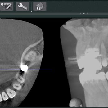 Sheldon Lu, DMD - 3D radiographic scan - Periodontists Near Me - Tustin, California Sheldon Lu, DMD - 3D radiographic scan - Periodontists Near Me - Tustin, California
