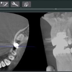 Sheldon Lu, DMD - 3D radiographic scan