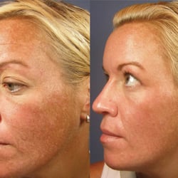 Clear Skin Med Spa