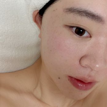 Avant MedSpa - Medical Spas Near Me - Irvine, California