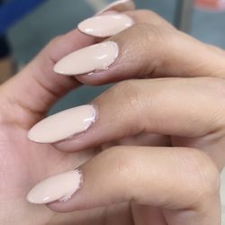 Gel fill