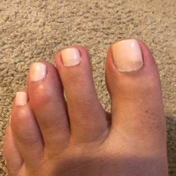 Nail Care Spa - Same stain on toes - Nail Salons Near Me - Atlanta, Georgia Nail Care Spa - Same stain on toes - Nail Salons Near Me - Atlanta, Georgia
