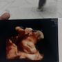 Photo of Moon Baby Ultrasound