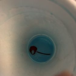 Steak ’n Shake - Stupid hidden cherry in my milkshake. Now I have to take allergy pills because they could not follow instructions.