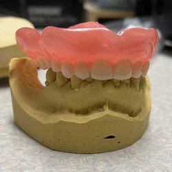 S & D Dental Laboratory - Immediate 3D printed denture