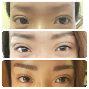 Tiffany Hur Makeup Artist - Top to bottom: Before, right after, & 1 day later - Massage Near Me - Glenview, Illinois
