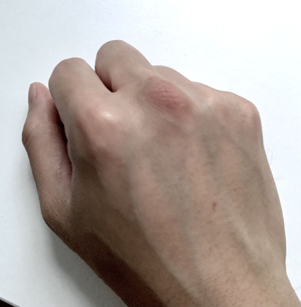 Perlman Clinic Kensington - patient advocate in San Diego, CA