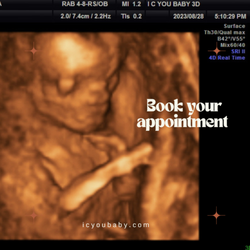 I C You Baby 3D