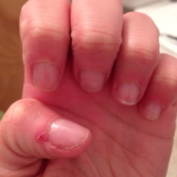 Worst gel manicure ever.