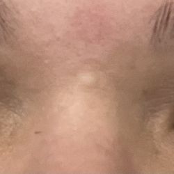 Lashes By Layci - Three days after placement.  Still look good!