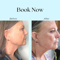 Radiance Wellness MediSpa