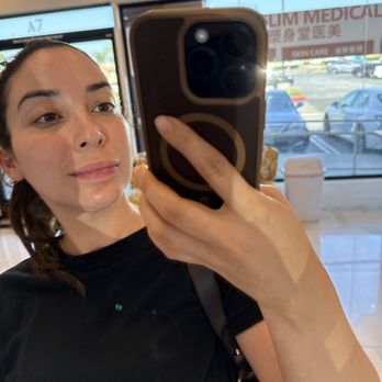 MS Slim - Facial - Weight Loss Centers Near Me - Chino Hills, California MS Slim - Facial - Weight Loss Centers Near Me - Chino Hills, California