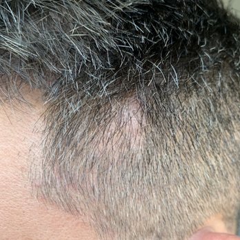 Jae Pak, M.D - Hair Loss Centers Near Me - Los Angeles, California