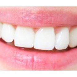 Advanced Family Dentistry
