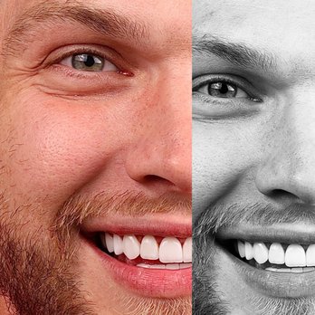 Cera Dentistry - General Dentistry Near Me - Houston, Texas