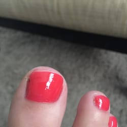 Sue's Nails - Uneven, old nail polish underneath, nail polish on my skin